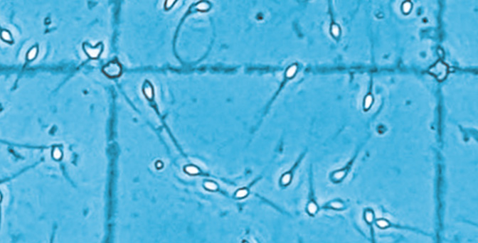 Spermiogramm basic